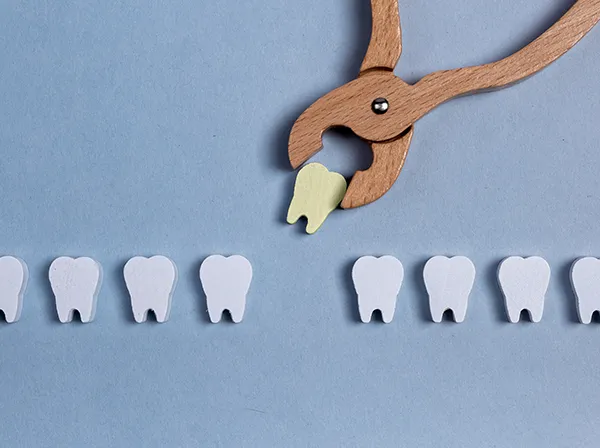Row of wooden tooth shapes, one of which is being pulled out of the row by dental pliers at United Smile Centres in Louisville, KY